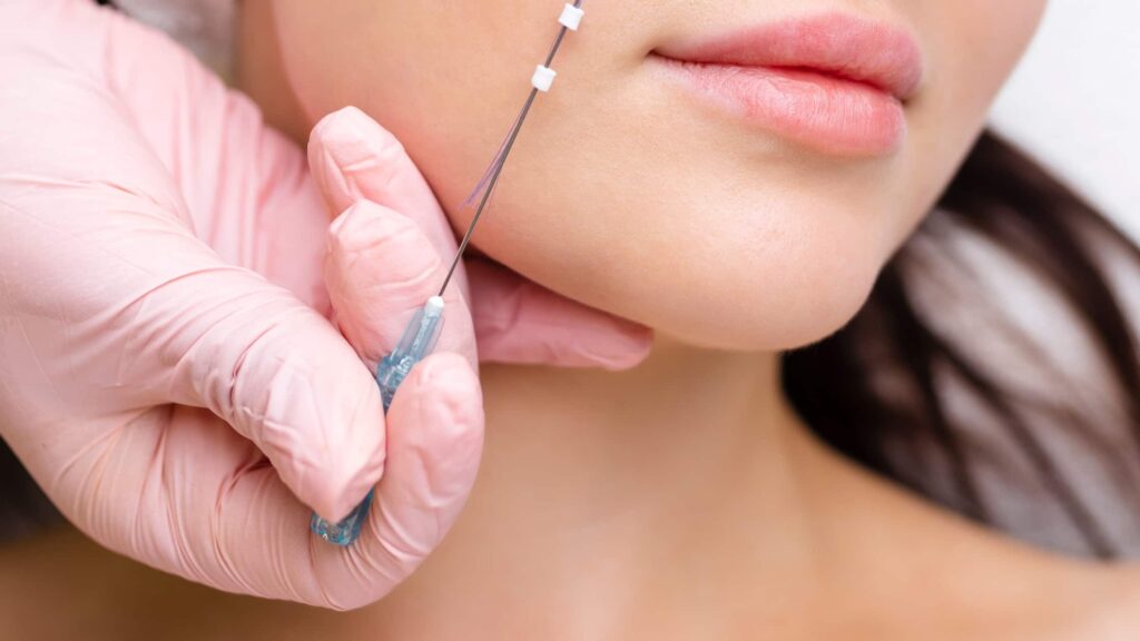 PDO vs. MINT PDO Threads: Which Non-Surgical Lift is Right for You?