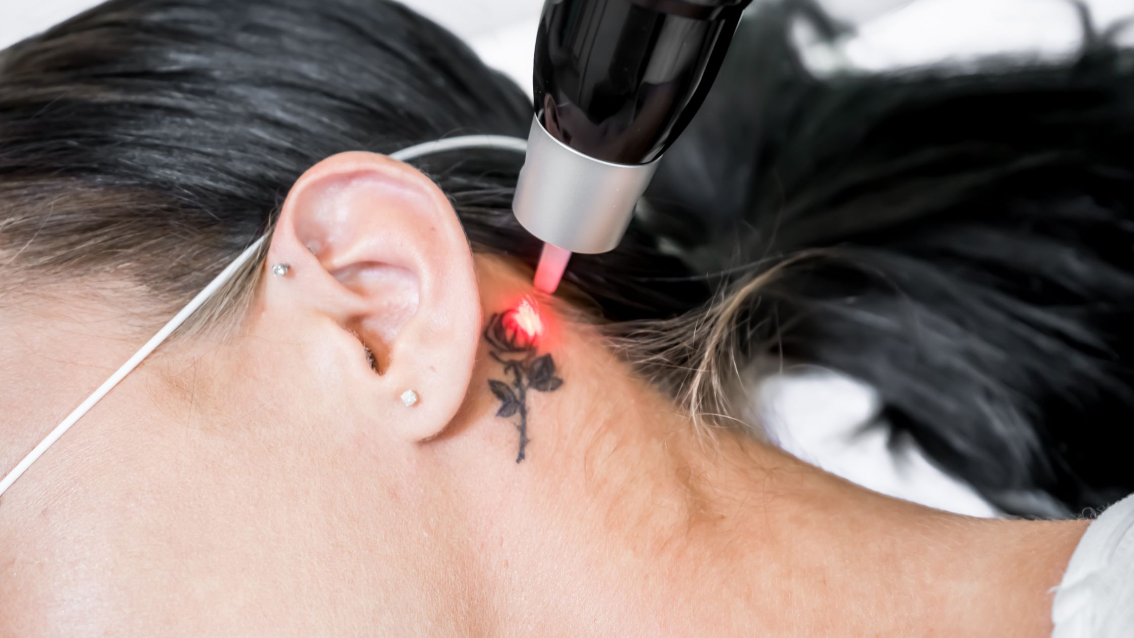 Black is the easiest colour of tattoo ink to remove, and grey wash  shadowing responds particularly well to laser tattoo removal. Thinking of  removing... | By Laser Tattoo Removal AustraliaFacebook