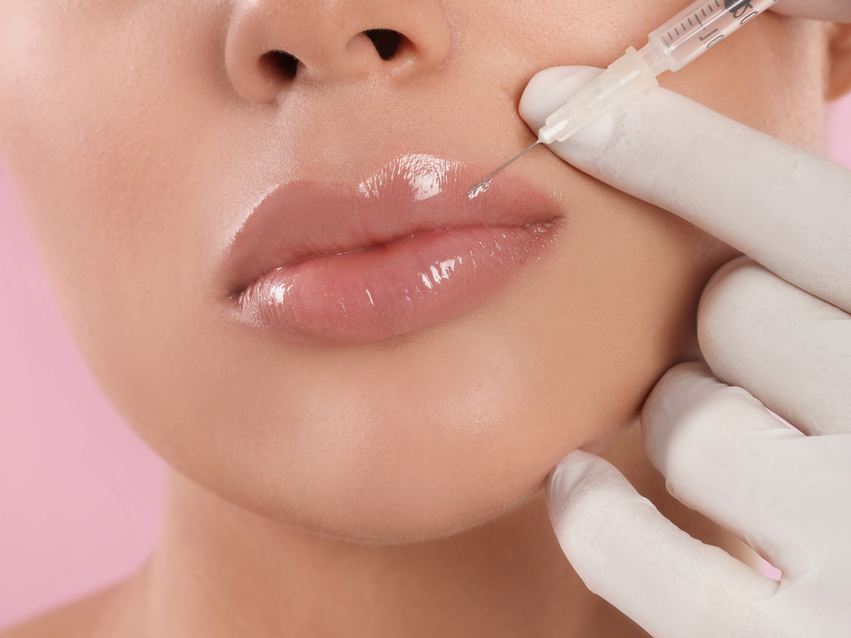 Guide to lip filler