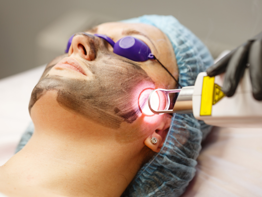 best laser treatments to reduce wrinkles