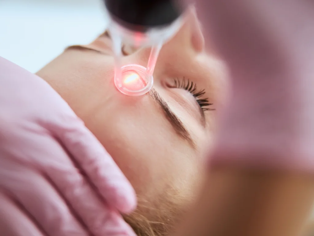 CO2 Laser Before & After Care Tips